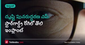 దృష్టి పునరుద్ధరణ చిప్: స్టార్‌గార్డ్ట్ రోగిలో తొలి ఇంప్లాంట్