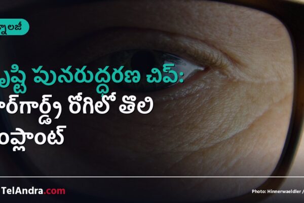 దృష్టి పునరుద్ధరణ చిప్: స్టార్‌గార్డ్ట్ రోగిలో తొలి ఇంప్లాంట్