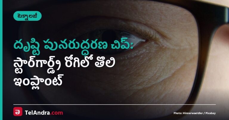 దృష్టి పునరుద్ధరణ చిప్: స్టార్‌గార్డ్ట్ రోగిలో తొలి ఇంప్లాంట్